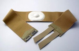 Umbilical hernia Umbilical hernia