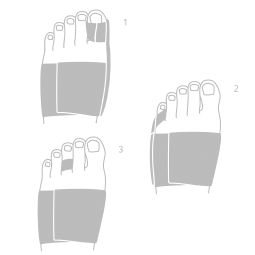 Toe Alignment Splint (TAS) - klik for at se billedet i fuld størrelse - åbner i nyt vindue Toe Alignment Splint (TAS)