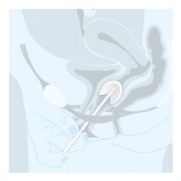Contrelle Activgard - klik for at se billedet i fuld størrelse - åbner i nyt vindue Contrelle Activgard