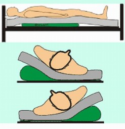 A/D-Surcon Antidecubitus/Turn System A/D-Surcon Antidecubitus/Turn System