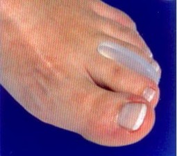 Toe splitter