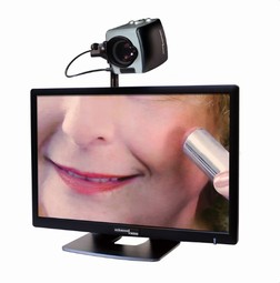 Acrobat HD Ultra - click to see picture in full size - opens new window Acrobat HD Ultra