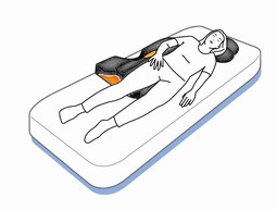 Positioning Wedges 30 degrees